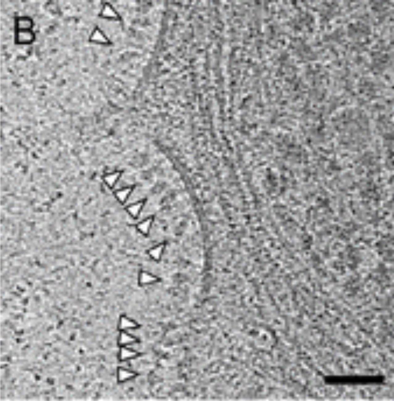 Protéines de pointe à la surface des cellules à la suite du vaccin Astrazeneca