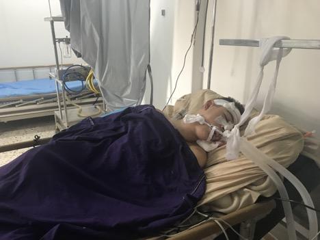 15 year old Ibrahim Fares lying on life support after shrapnel had passed through his brain. He died a few days after my visit. (Photo: Vanessa Beeley)