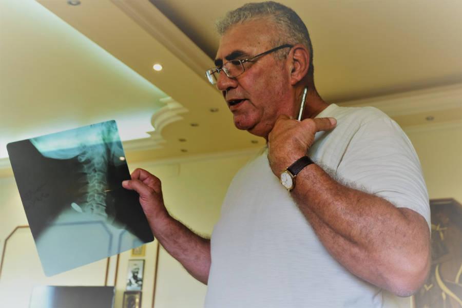 Commander Simon Al-Wakil shows me the x-ray of the terrorist sniper bullet that lodged in his neck. (Photo: Vanessa Beeley)